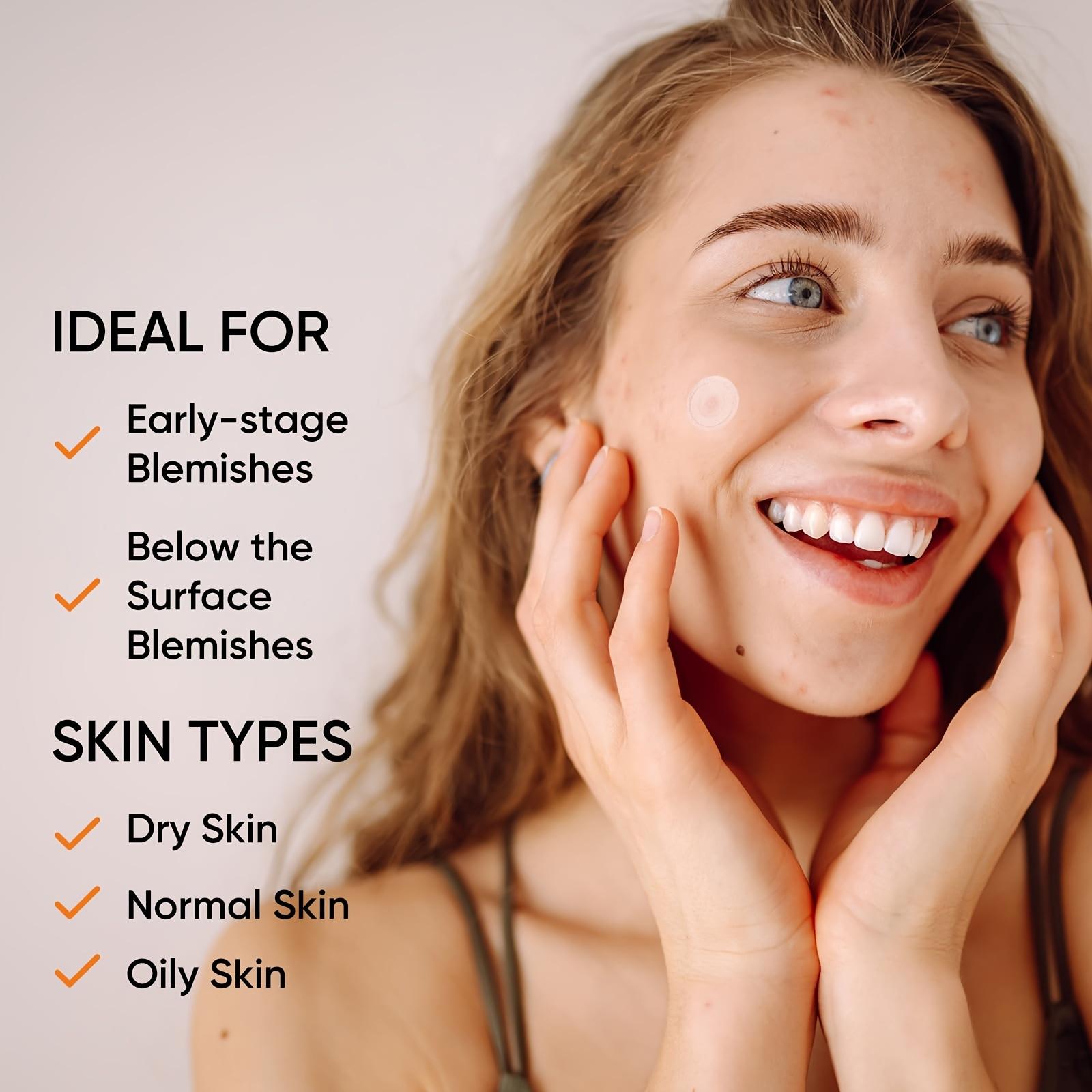 แผ่นแปะสิวไฮโดรเจลขนาดใหญ่พิเศ - Xl Skincare บทวิจารณ์และราคา