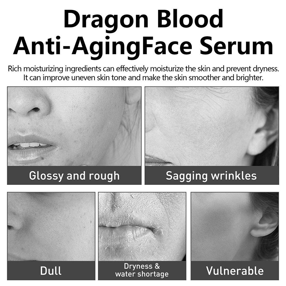 Dragon Blood Cream กําจัดริ้วร - Skincare Retinol บทวิจารณ์และราคา